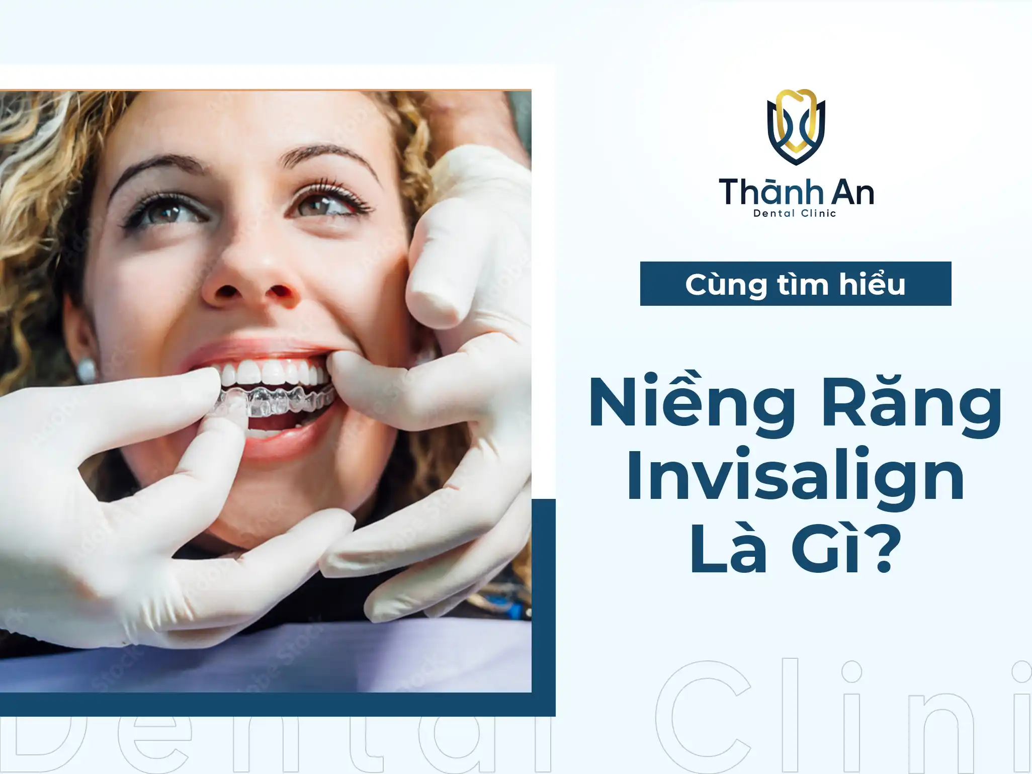 Niềng Răng Invisalign Là Gì? Niềng Răng Invisalign Có Tốt