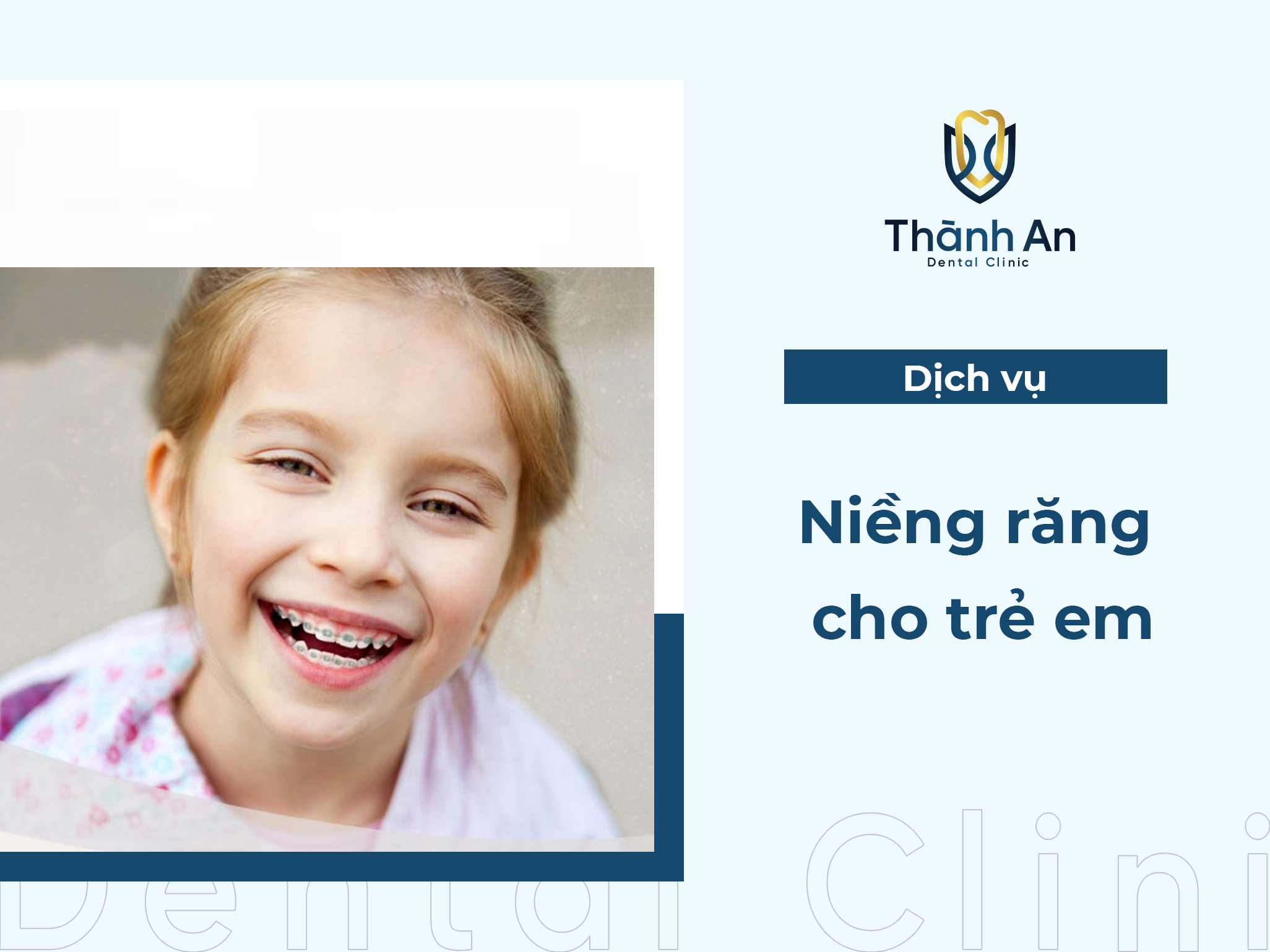 Niềng răng trẻ em UY TÍN - AN TOÀN 