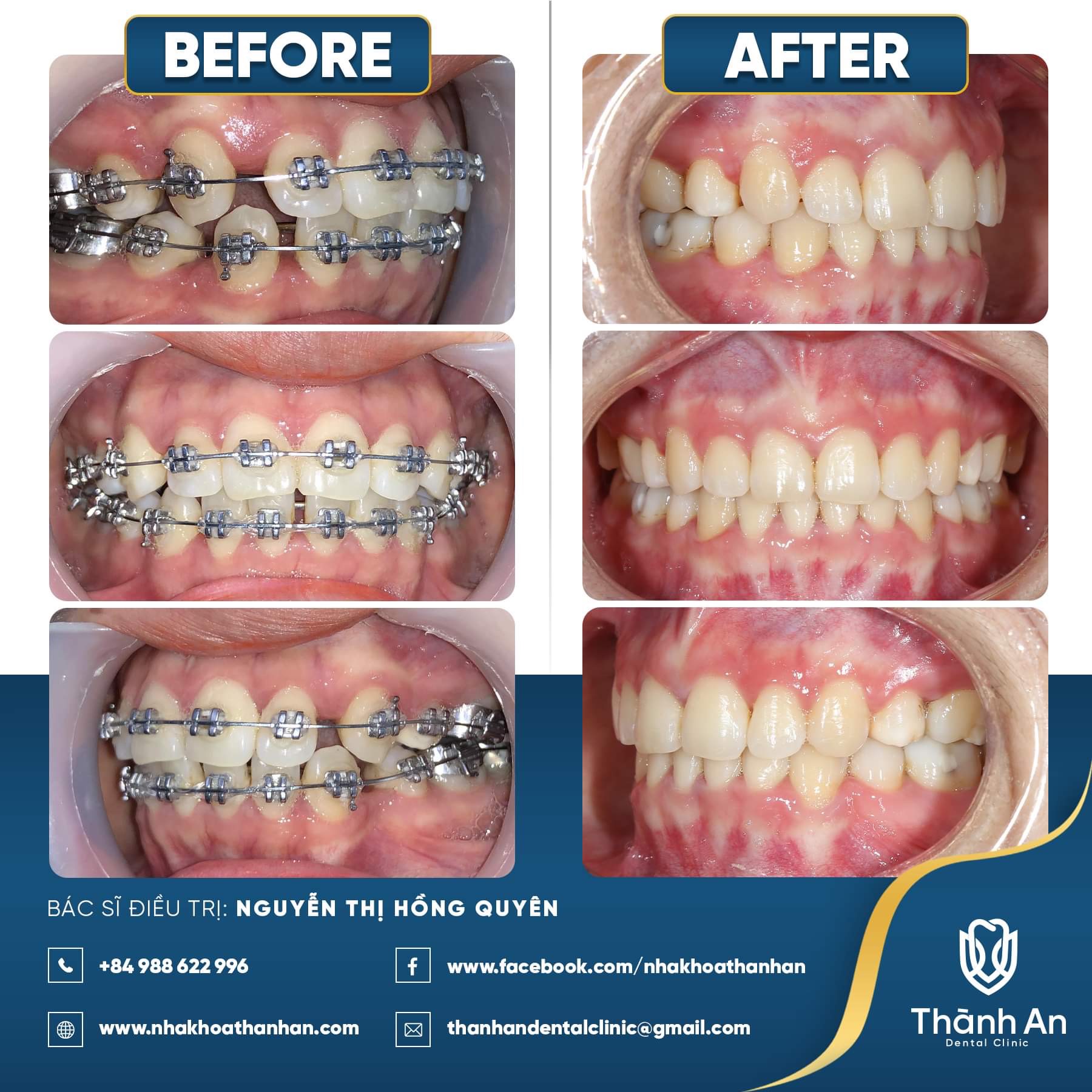 BSĐT: Phan Trung Tiệp